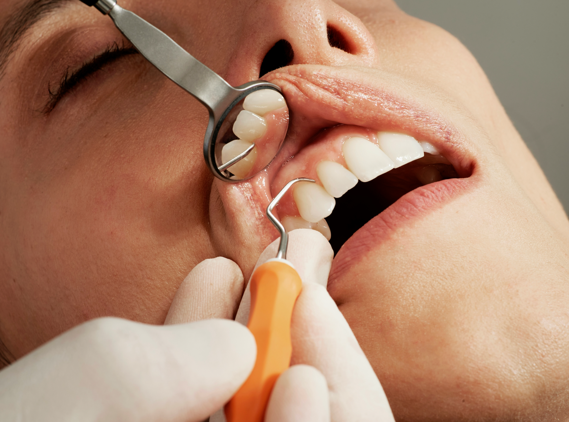 How to Choose the Right Type of Dentist for Implants: Specialist vs General [Expert Guide]